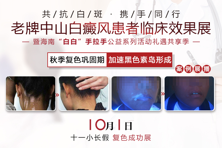 老牌中山白癜风医院 暨海南“白白”手拉手•公益系列活动礼遇共享季