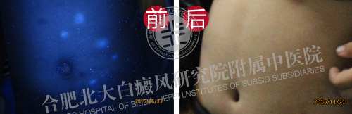 【第219面锦旗】5岁孤儿走出“黑白”世界,北大