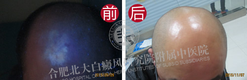 【第220面锦旗】不惑之年遭遇白斑 今朝康复送锦