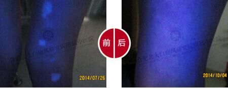 【第224面锦旗】突遇白斑喜康复,母亲锦旗致谢