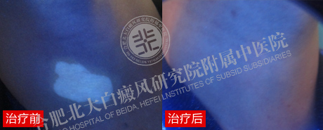 【第223面锦旗】90后父亲告别白斑重新撑起一个家