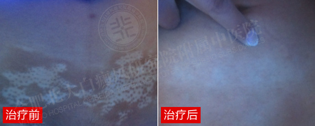 【第226面锦旗】大学生的自白:我找回了自信,