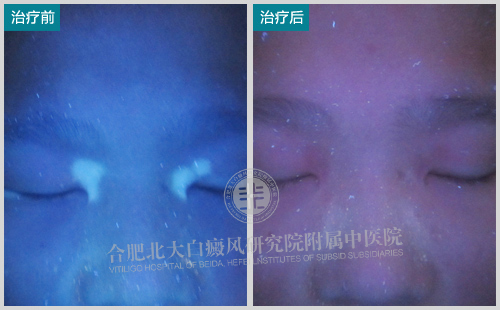 【第228面锦旗】年迈爷爷心愿:治好孙子白斑