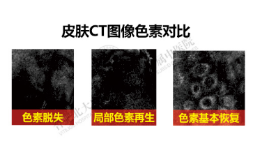 三维皮肤CT检测系统
