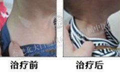 怎么才能检查出白癜风的病因 